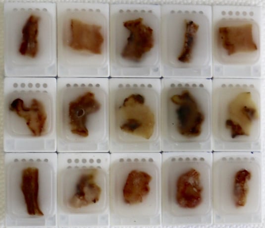 Blocs de tissus FFPE